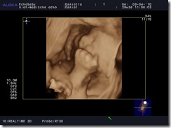 Daniella_20100403_REALTIME-_3D-__0014