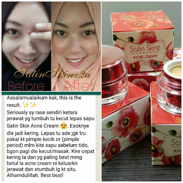 Satin Skinz Facial Acne Cream / Satin Skin Botanical (Acne) Serum Murah