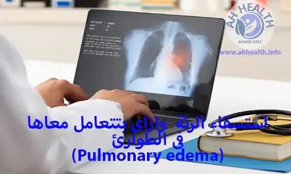 استسقاء الرئة (Pulmonary edema) وازاى بتتعامل معاها فى الطوارئ