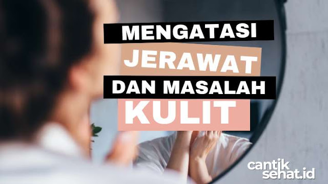 Mengatasi Jerawat dan Masalah Kulit Lainnya