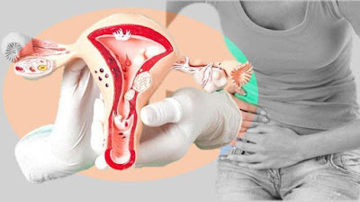 5 Triggers for Uterine Cysts, Recognize the Symptoms as Fast as Possible