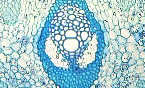 plant cell animal cell venn diagram. plant cell and animal cell