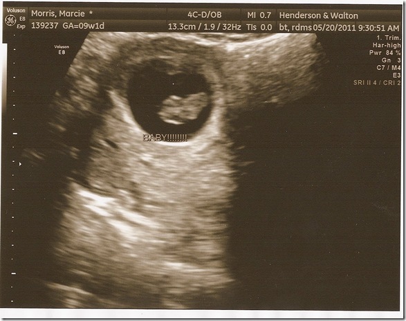8 weeks 3 days3