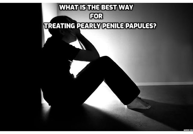 Treating Pearly Penile Papules - If you want an effective method of treating pearly penile papules, read on here to learn about the Pearly Penile Papules Removal Program. You will learn more about this treatment and will find out the steps which must be undergone in order to get rid of the pearly penile papules forever. 