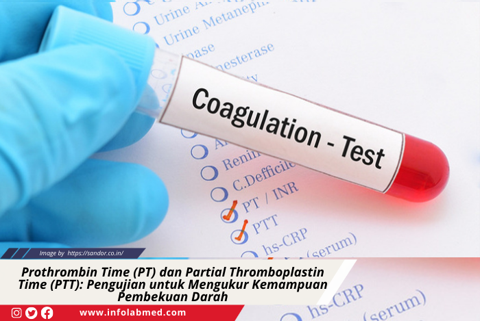 Prothrombin Time (PT) dan Partial Thromboplastin Time (PTT) Pengujian untuk Mengukur Kemampuan Pembekuan Darah