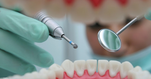 Dental Caries Treatment Market Growth