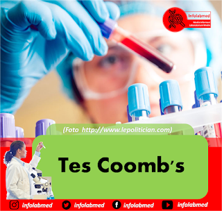 Tes Coomb's