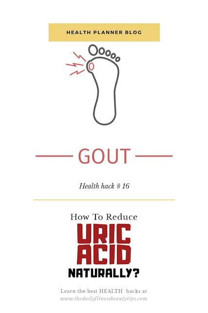 Uric-acid-gout-treatment