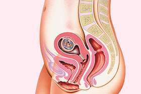 6 weeks pregnant simulation