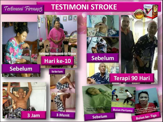 Jual Obat Stroke di Tulungagung