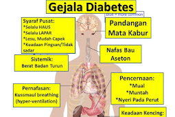 Jual Obat Herbal Diabetes Ampuh Di Halmahera Timur | WA : 0822-3442-9202