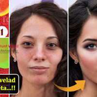 How to Lighten Skin Naturally In 20 Minutes, Superb Home Remedy!
