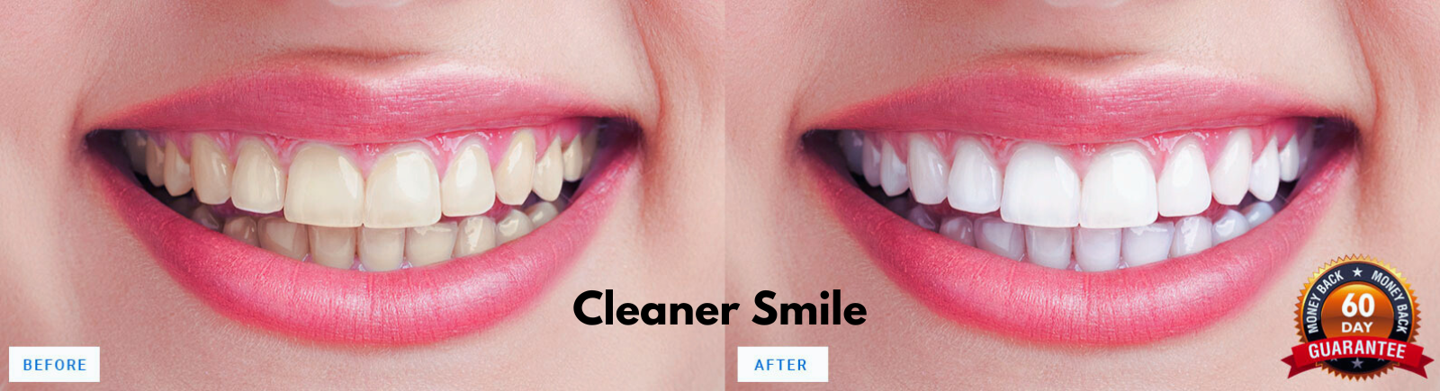 Cleaner Smile Teeth Whitening Kit Review