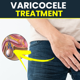 Natural treatment for varicocele