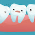 Răng khôn mọc kẹt có nhổ bỏ được không?