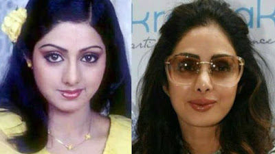 actresses who looks horrible post cosmetic surgery!, ayesha takia plastic surgery, post cosmetic surgery, surgery photos of popular bollywood actresses, plastic surgery photos of popular bollywood actresses, plastic surgery photos, actresses who looks horrible post cosmetic surgery, horrible post cosmetic surgery, surgery gone wrong, bollywood actresses who looks horrible post cosmetic surgery, plastic surgery before and after