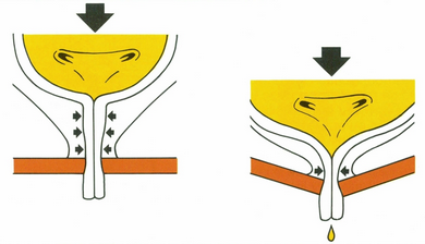 Incontinence urinaire - Levez le tabou de l incontinence