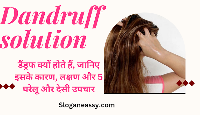 Dandruff solution in hindi