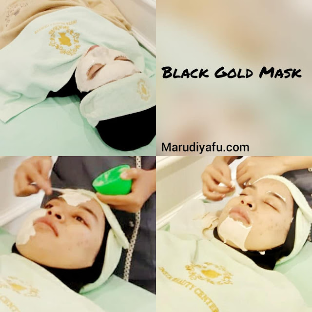 harga insta beauty center, harga perawatan di insta beauty center, insta beauty center price list, harga filler hidung di insta beauty center, klinik insta beauty center, beauty center jakarta, dokter siska beauty center