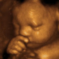 3d Ultrasound Images