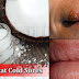 How To Treat Cold Sores - How To Get Rid Of Cold Sores Very Fat At Home