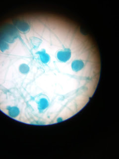 RHIZOPUS ASEXUAL REPRODUCTION