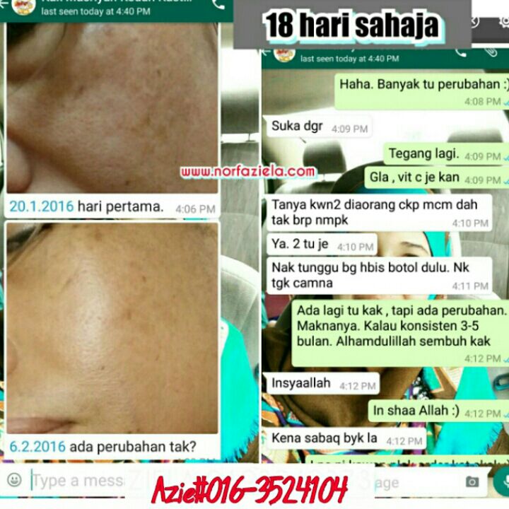 FEEL OUR BEAUTY: Krim Jeragat Paling Berkesan Di Farmasi 