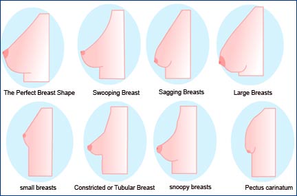 The Perfect Breast Houston Breast Augmentation