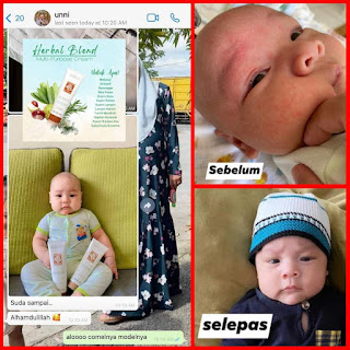 Krim Herbal Blend Shaklee Kebaikan Ingredients Untuk Bayi