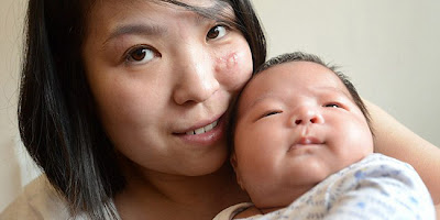 Kisah Seorang Wanita Yang Lahirkan Bayinya Dalam Kondisi Koma