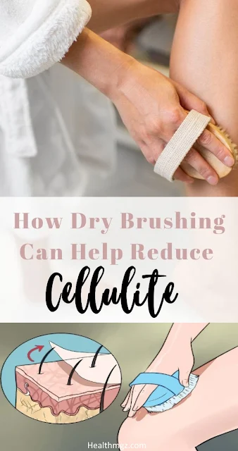 Dry Skin Brushing to Reduce Cellulite and How to do it
