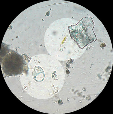 Micro Organisms living in the water