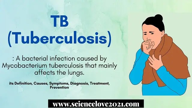 TB (Tuberculosis): Definition, Causes, Symptoms, Diagnosis, Treatment, Prevention