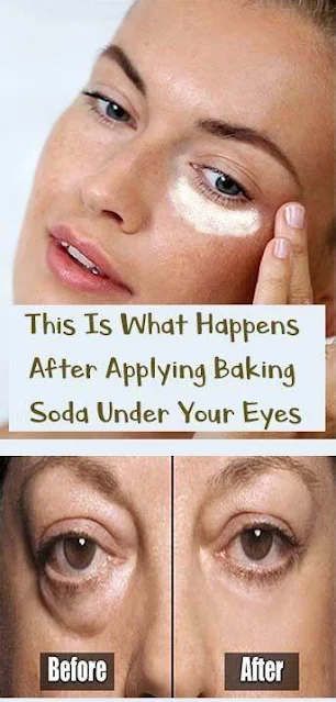 This Is What Happens After Applying Baking Soda Under Your Eyes