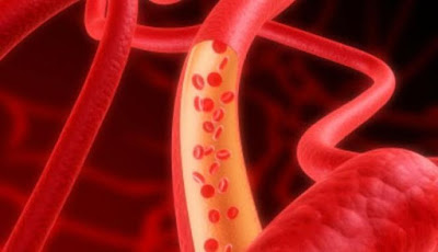 9 Tanda Sirkulasi Darah Tubuh Anda Buruk