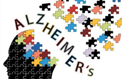 Alzheimer's Symptoms, Management and Research