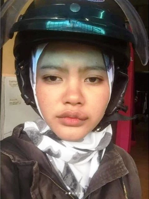 Lupa Pakai Masker Saat Naik Motor! Bibir Wanita Ini di Gigit Serangga Sampai Bengkak