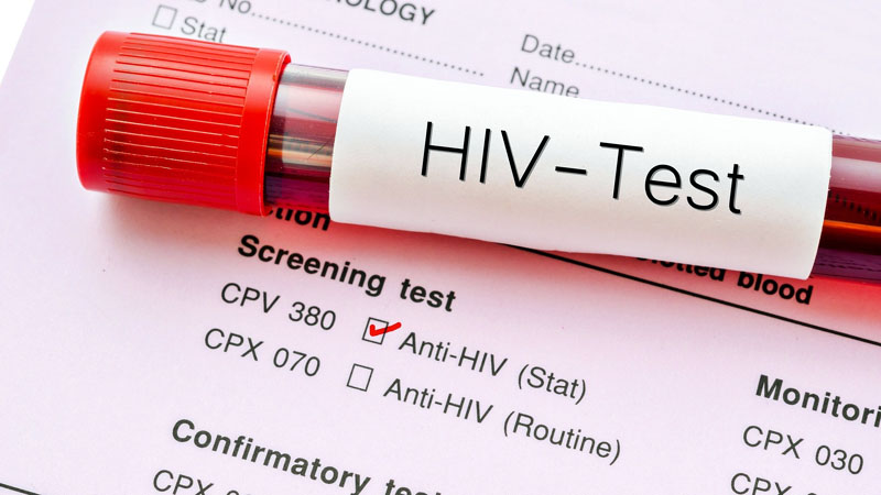 5 Reasons to Get an HIV Test Today