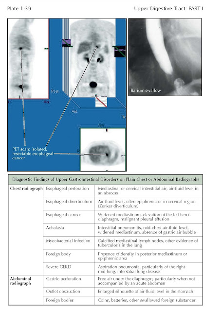 Diagnostic Aids in Gastric Disorders, hypergastrinemia