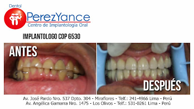  www.dentalperezyance.com