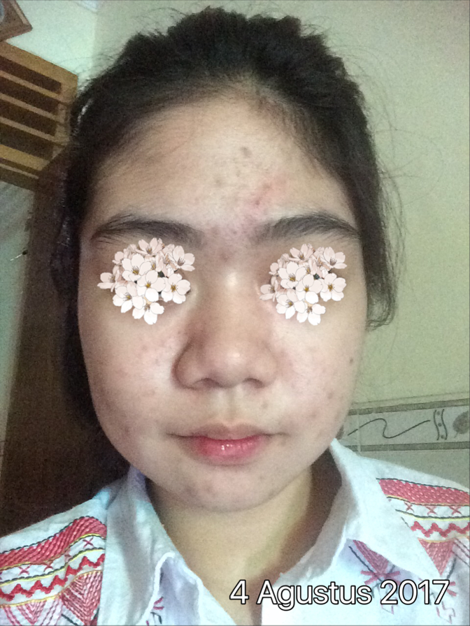 Gambar