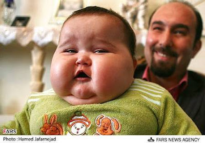 Unbeliveable 20 kg baby born in Tehran,Iran