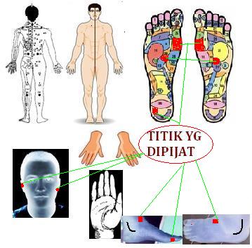 Teknik Titik Refleksi  Refleksi Terapi