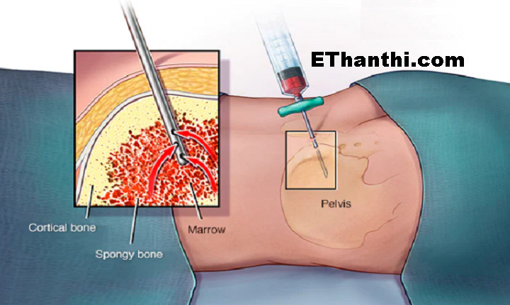 பயாப்சி செய்வது என்பது என்ன? #biopsy