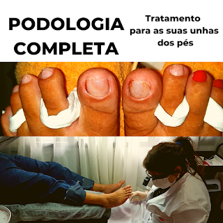 Tratamento para unhas encravadas