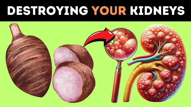 These 10 Foods Are Destroying Your KIDNEYS: The Main ENEMIES of Your KIDNEYS We Constantly Consume