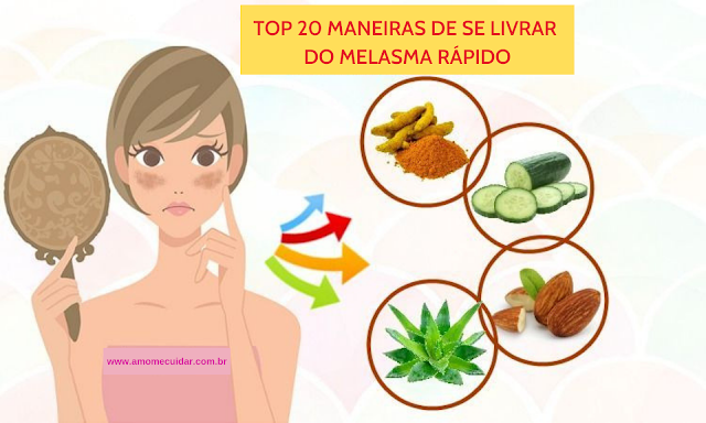 como se livrar do melasma