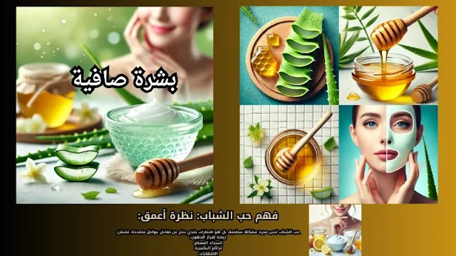 تهدئة حب الشباب بالصبار