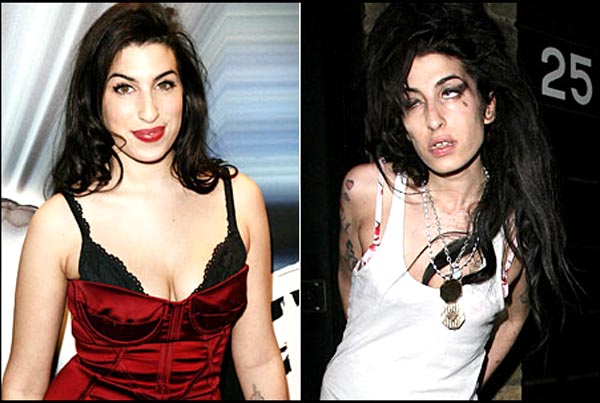 Amy Winehouse Before And After