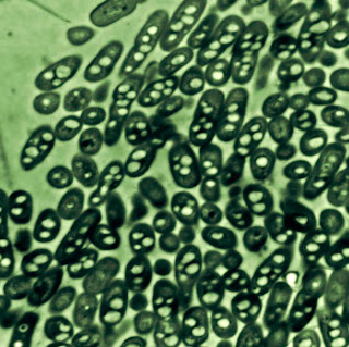 Ralstonia eutropha bacteria